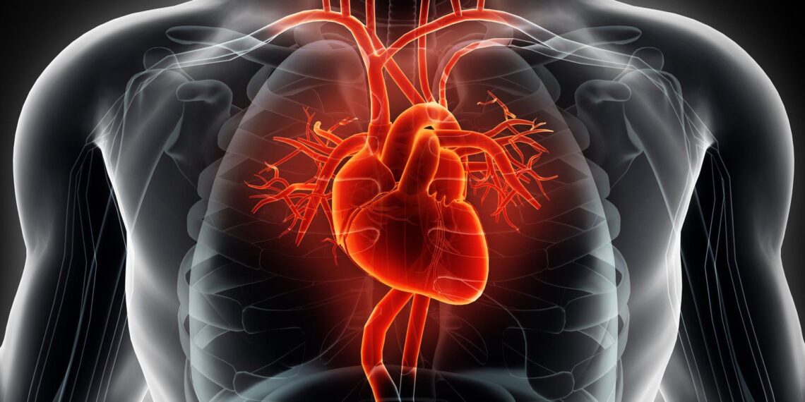 Widow Maker Heart Attack: Causes, Symptoms, Treatment