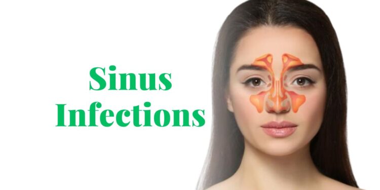 Are Sinus Infections Contagious? Debunking the Myths and Facts