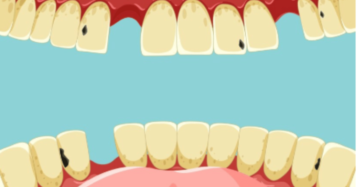 Tooth Gap: Understanding the Space Between Smiles