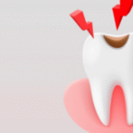 small cavity