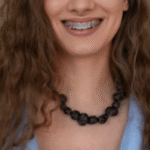 silver braces