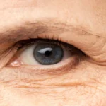 Aging Eyes and Cataracts