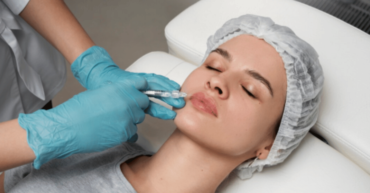 lip enhancement fillers